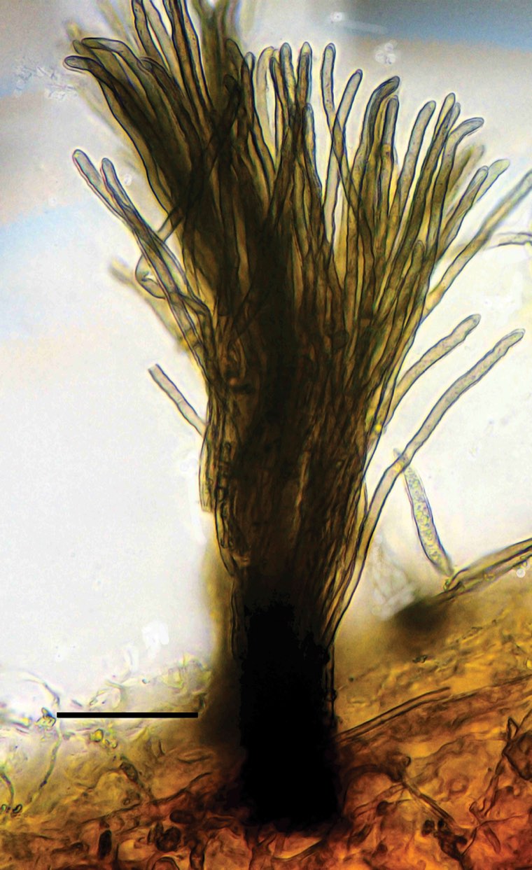 Microscope view of a spore-bearing tuft (synnema) of Pseudocercospora griseola, the angular leaf spot fungus