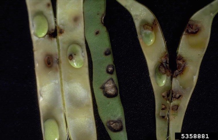 Bean pods with sunken, dark-bordered anthracnose lesions