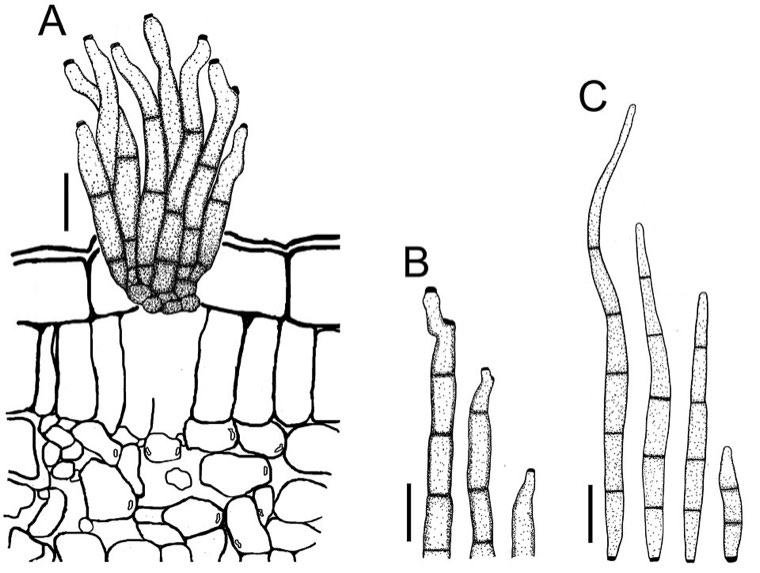 Drawing of the microscopic spore-bearing structures of Passalora arachidicola, the early leaf spot fungus