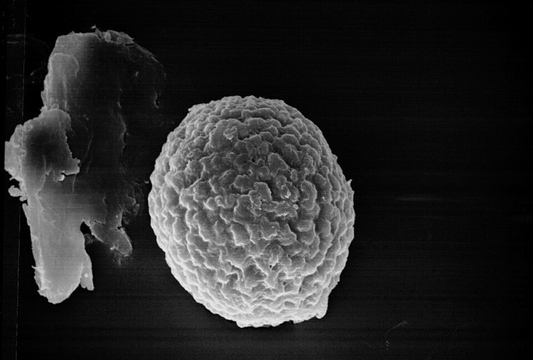 Spiny teliospore of the Karnal bunt fungus (scanning electron micrograph)
