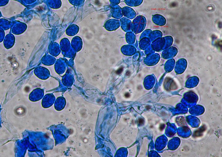 Conidiophores and conidia of Peronosclerospora sorghi under the microscope
