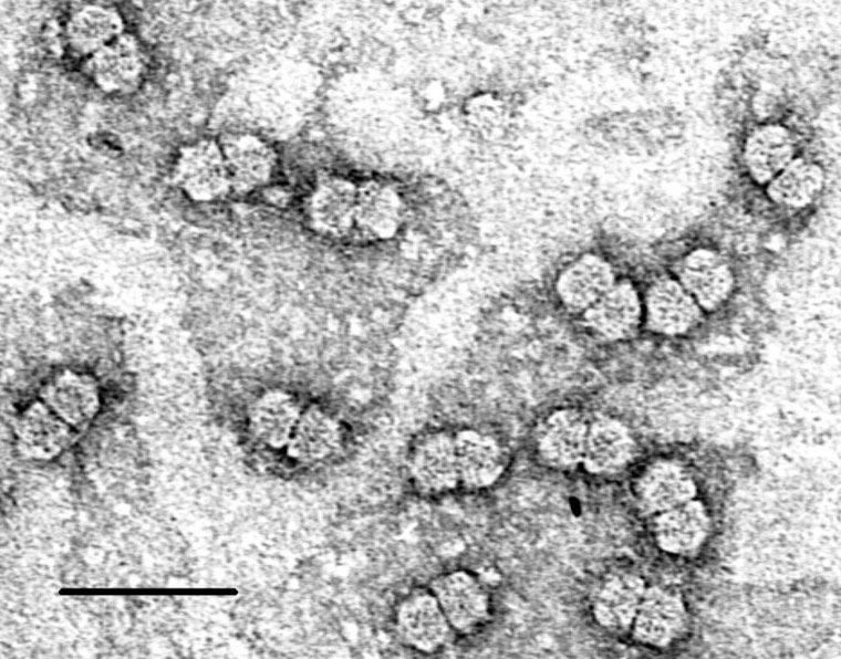 Electron micrograph of twinned maize streak virus particles