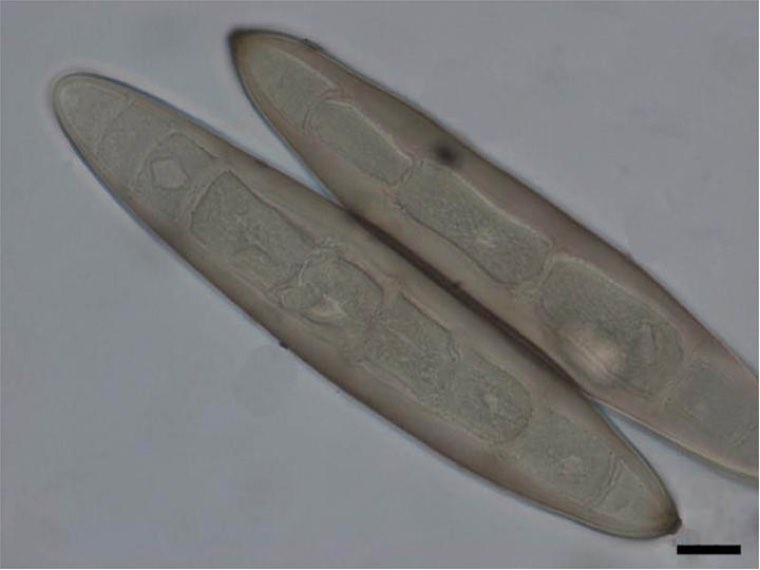 Conidia of Exserohilum turcicum under the microscope