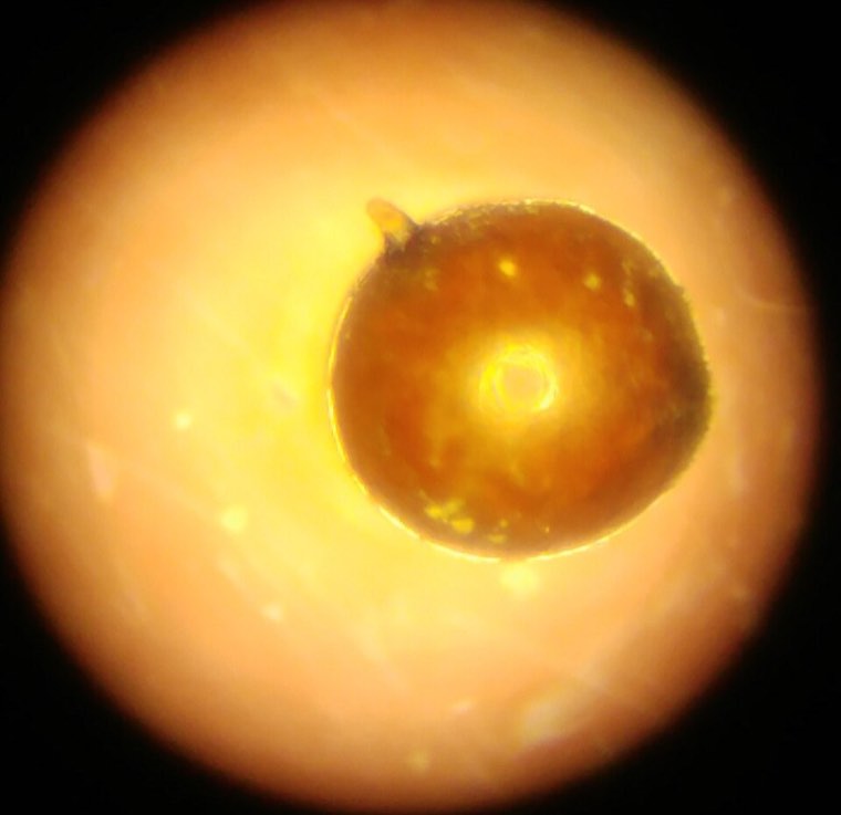 A single potato cyst nematode cyst under magnification
