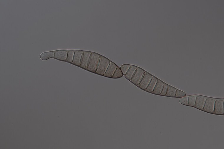 Conidia of Bipolaris oryzae under the microscope