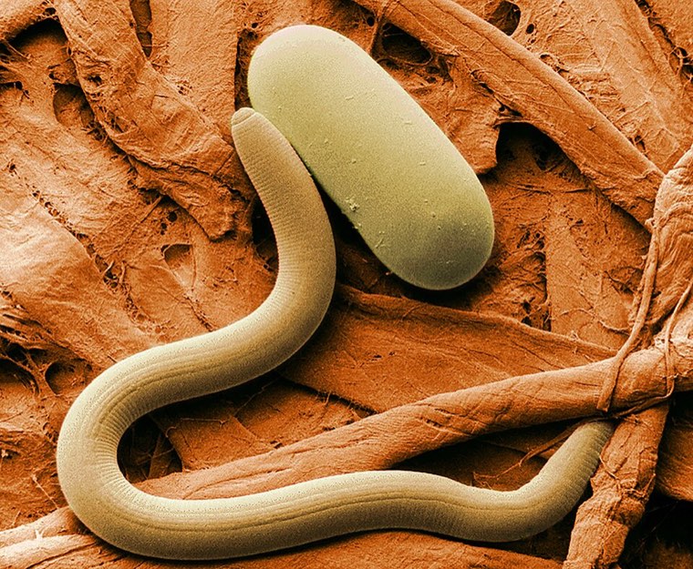 Scanning electron micrograph of a soybean cyst nematode juvenile and its egg