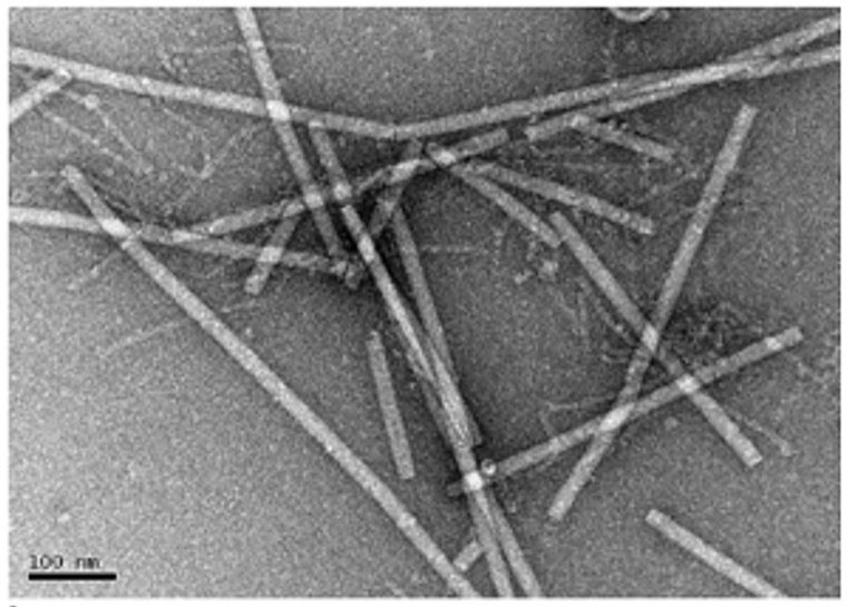 Electron micrograph of rod-shaped tomato brown rugose fruit virus particles